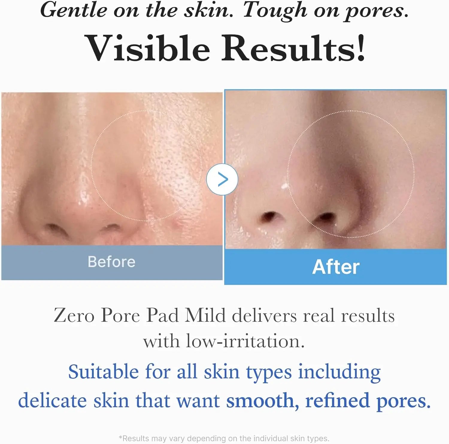 medicube Toner Pads Zero Pore Pad 2.0 Facial Pad for Exfoliation and Pore Care with AHA Lactic Acid